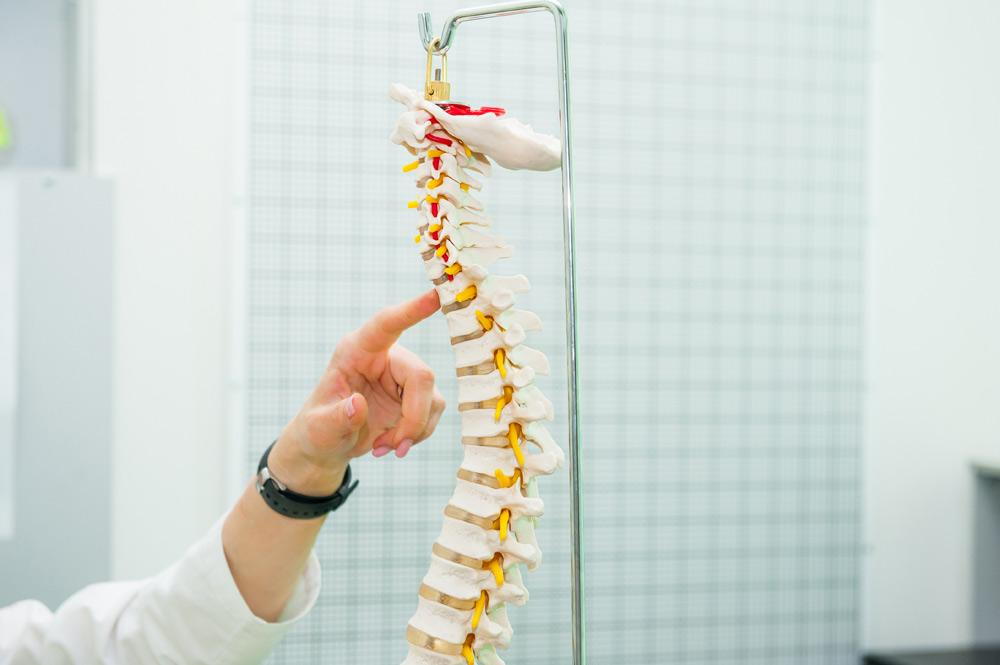 Scoliosis FAQs